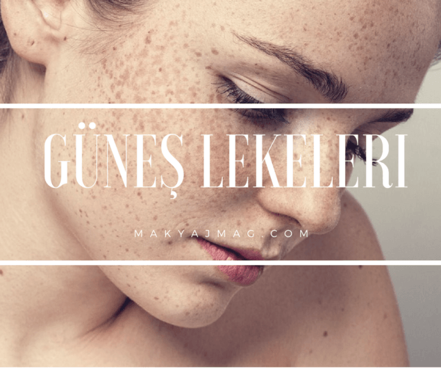 Güneş Lekesi Nasıl Geçer? Güneş Lekesi Nasıl Geçer?
