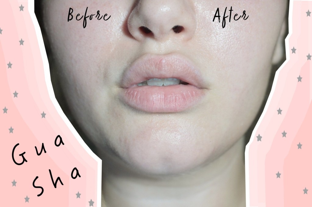 Gua Sha Nedir Gua Sha Tasi Nasil Kullanilir