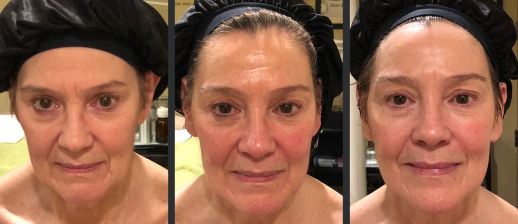 Gua Sha Nedir Gua Sha Tasi Nasil Kullanilir