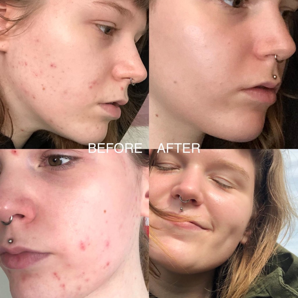 The Ordinary En Iyi 5 The Ordinary Urunu